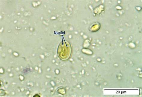 Giardia species - Learn About Parasites - Western College of Veterinary Medicine | University of ...