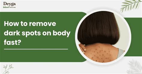 How to Remove Dark Spots of Body Faster?