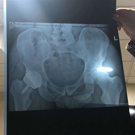 Andy Murray Accidentally Shared A Photo Of His Penis With 1.6 Million ...