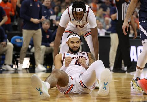 Johni Broome injury: What happened to the Auburn forward?