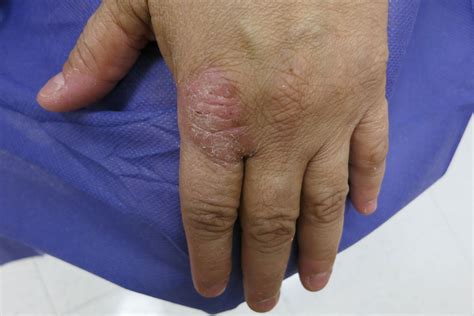 Tips to keep lips, hands and skin soft and smooth during dry winter conditions - Gossip Health