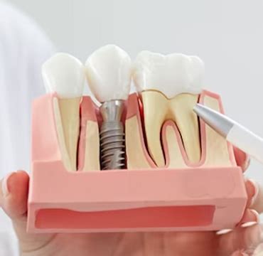 Invisalign treatment in Madipakkam | Best orthodontist in nanganalur