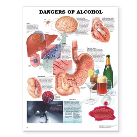 Buy Dangers of Alcohol Anatomical Chart Book Online at Low Prices in ...