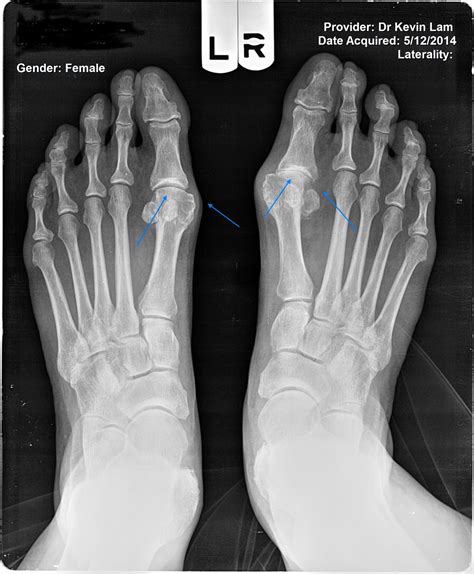 May | 2018 | Ric Size