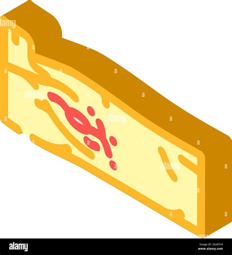 lymph node dissection surgery isometric icon vector. lymph node dissection surgery sign ...