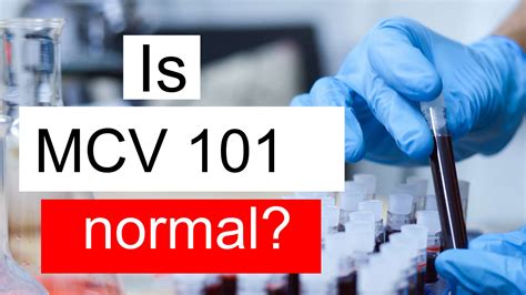 Is MCV 101 normal, high or low? What does Mean corpuscular volume level 101 mean?