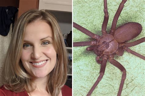 What Does A Brown Recluse Spider Bite Feel Like At First - Infoupdate.org