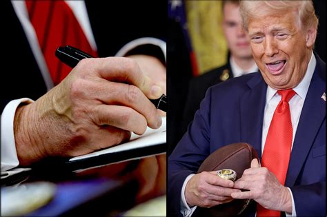 Trump Appears to Conceal Another Hand Bruise Days After Touting He Received 'Highest Mark' on ...
