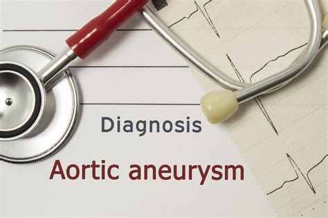 Recommendations for Abdominal Aortic Aneurysm Screening - AAPC Knowledge Center