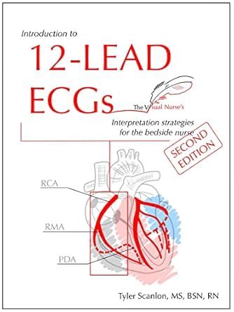 Introduction to 12-Lead ECGs: Interpretation Strategies for The Bedside ...