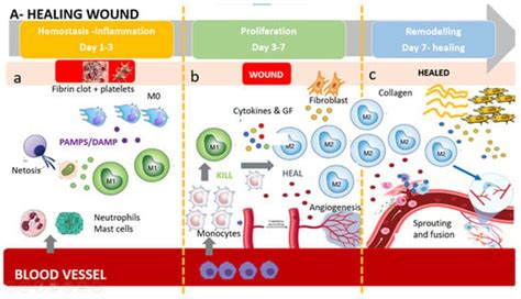 The Immune-Centric Revolution in the Diabetic Foot: Monocytes and ...