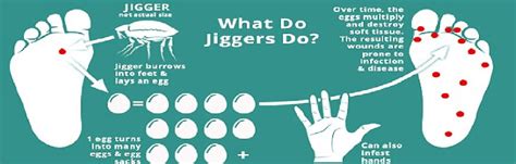 Image result for Jigger Bug Parasite