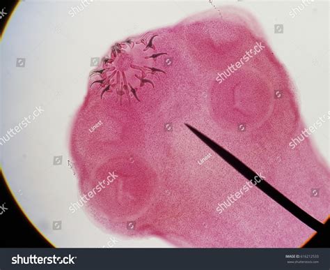 Taenia Solium Scolex Cestodes: Taenia Solium (Pork Tapeworm Life