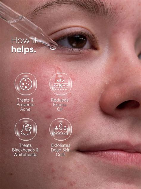 Minimalist 2% Salicylic Acid Face Serum for Men & Women | Acne ...