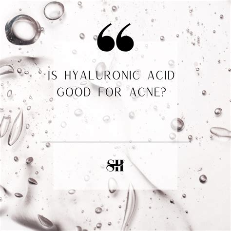 Is Hyaluronic Acid Good For Acne? - Skin Harmonics