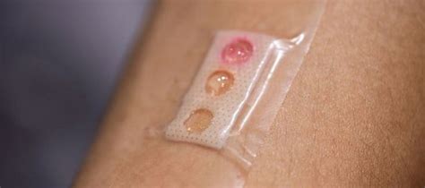 Image result for Non-Invasive Health Monitor