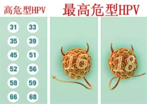 做hpv检查多少钱（7成以上女性都会感染的HPV病毒- 莱绘画网