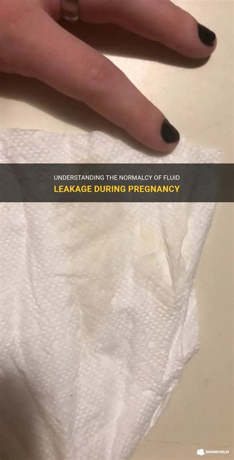 Understanding The Normalcy Of Fluid Leakage During Pregnancy | ShunChild