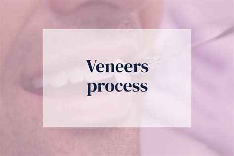 Trident Smiles Dental | Veneers process: step-by-step guide to the veneer procedure