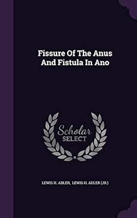 Fissure Of The Anus And Fistula In Ano : Adler, Lewis H, Lewis H Adler ...