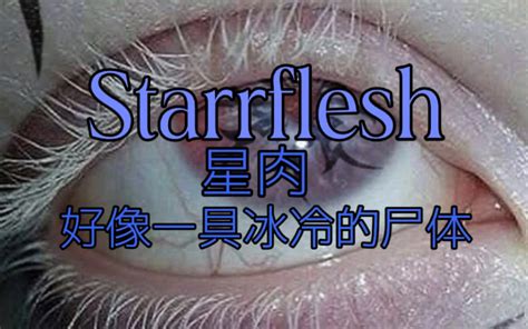 Starrflesh Leak