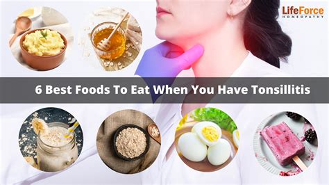 List Of Soft Foods To Eat After Tonsillectomy | Detroit Chinatown