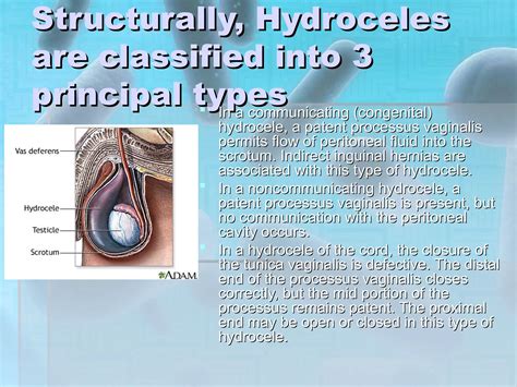 Reproductive System Disorders 的图像结果