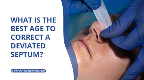 Deviated Septum Surgery Pictures