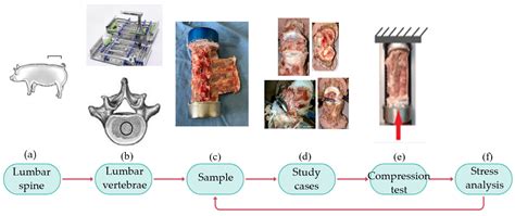 Experimental Analysis of Stress Shielding Effects in Screw Spacers Placed in Porcine Spinal Tissue