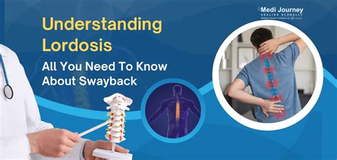 โรคหลังค่อม (Lordosis): สาเหตุ การรักษา และการออกกำลังกาย