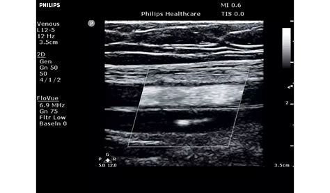 Philips - ClearVue 850 Diagnostic confidence you can trust - Philips