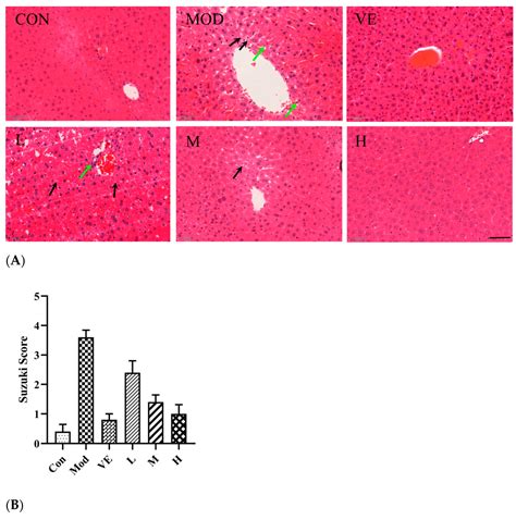 Anti-Inflammatory Effect of Columbianadin against D-Galactose-Induced ...