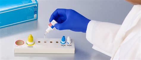 Image result for Lab Room Point of Care Testing Picture