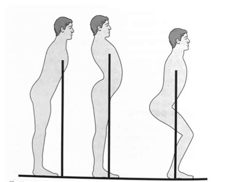 Image result for Contralateral Gait