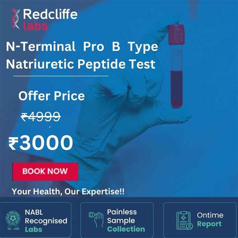 NT Pro BNP Test - Price, Purpose, Procedure, Results, & More