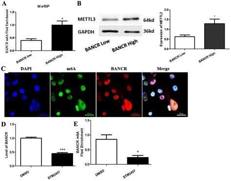 STM2457 Inhibits the Invasion and Metastasis of Pancreatic Cancer by ...