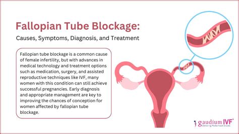 Image result for Fallopian Tube Blockage Surgery