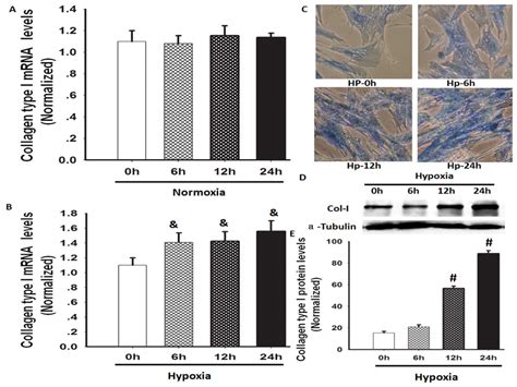 Hypoxia-Induced Collagen Synthesis of Human Lung Fibroblasts by ...