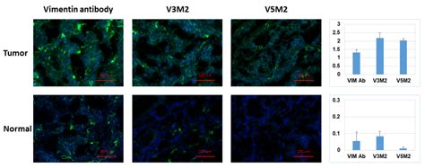 Selection and Characterization of Vimentin-Binding Aptamer Motifs for ...