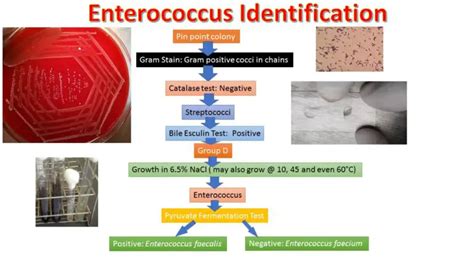 Image result for Enterococcus Faecalis Hemolytic Activity