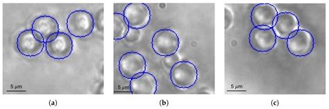 An Accurate Perception Method for Low Contrast Bright Field Microscopy ...