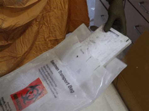 CAR-T Cell Therapy in Gujarat | CIMS Hospital Achieves Breakthrough ...