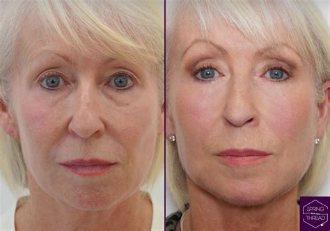 Spring Thread 的图像结果