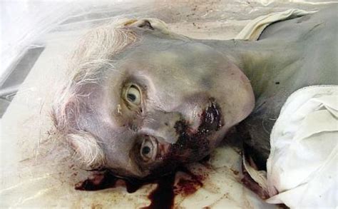 全球罕见怪病怪病2022已更新今日推荐