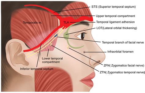 Swelling At The Temples