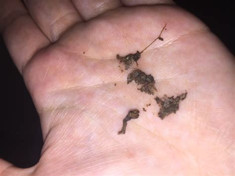 Clumpy Discharge 的图像结果