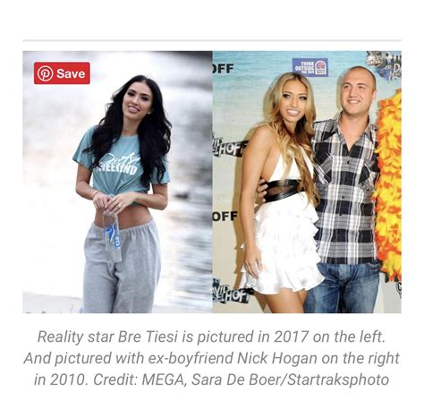 Bre Tiesi Face Surgery