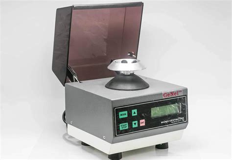 Microcentrifuge (fixed rotor speed 10000 rpm) with digital timer/rpm ...