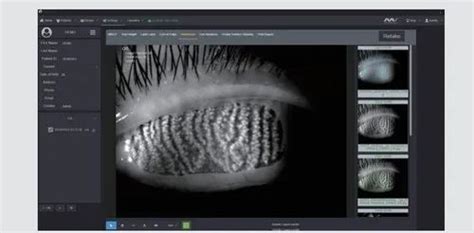 Eye Testing Equipment - Eyevis Visual Field Perimeter model EP 1 Trader ...