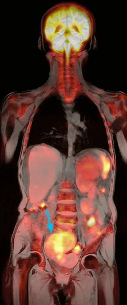 Image result for Inner Imaging Body Scan